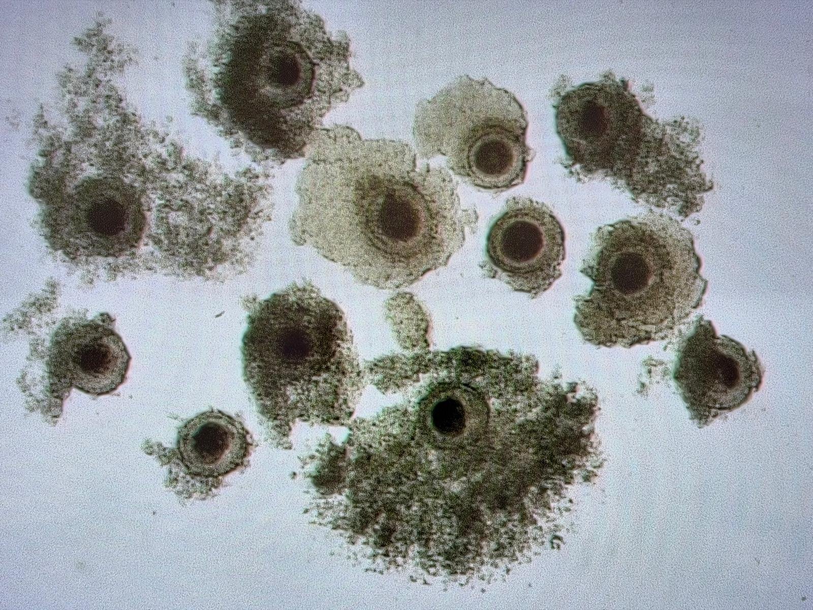 Immature Oocytes