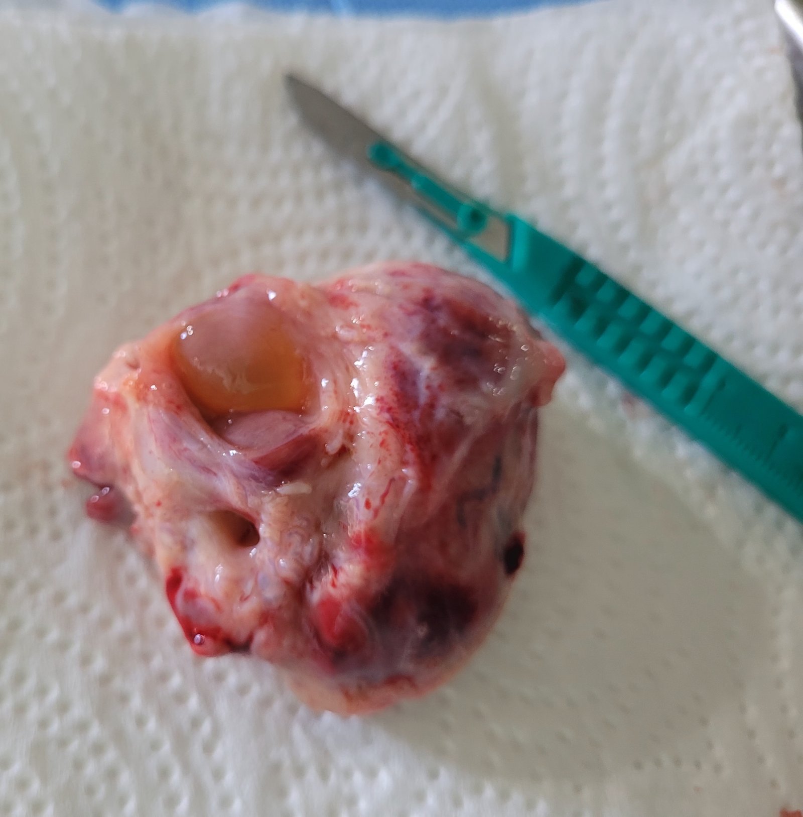 Post-Mortem Ovary Harvest